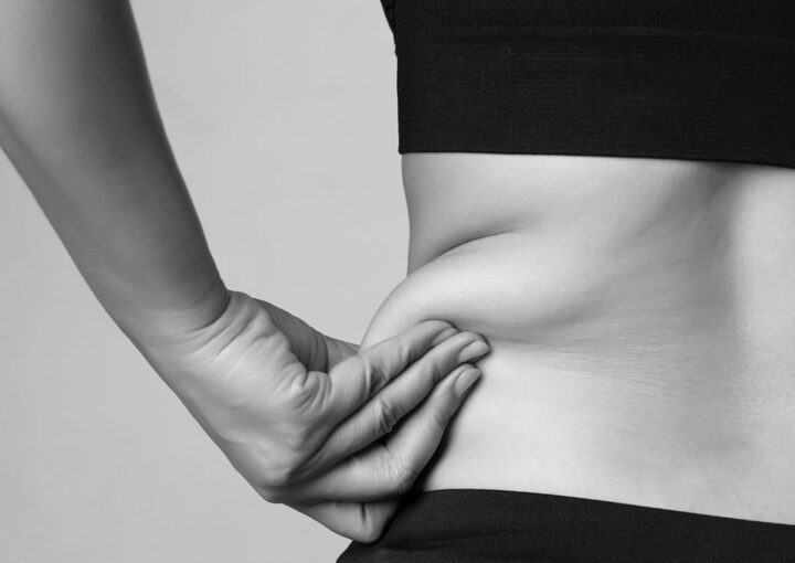 Kryolipolyse-Behandlung Antwerpen