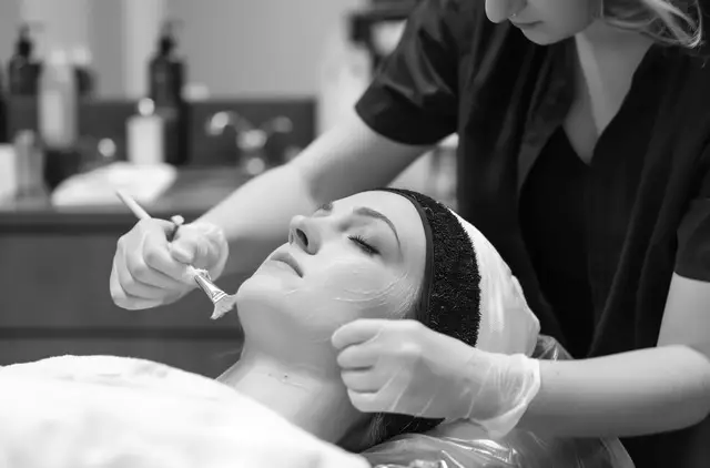 TCA Peeling Antwerpen