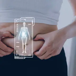 Voor en na resultaten van de cryolipolyse behandeling